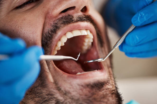 Best Dental Fillings (Composite and Amalgam)  in Broadview, IL